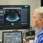 A nurse looks at an ultrasound scan on a scree