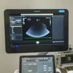 Ultrasound scan on screen